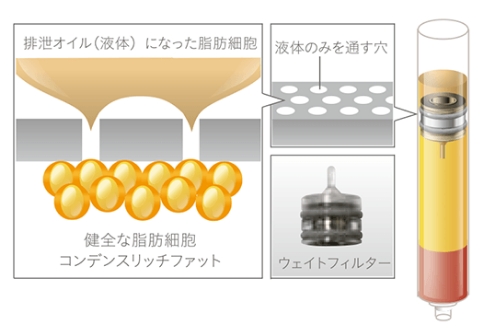 CRF（コンデンスリッチファット）とは