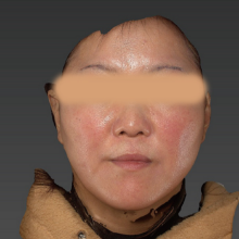 術後3