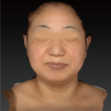 術前1